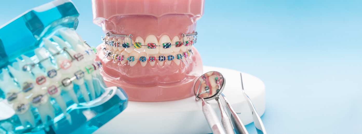 Konya ortodonti sonrası estetik gülüş tasarımı DentReal Meram