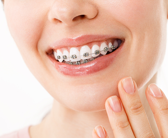 Konya diş teli tedavisi - DentReal Meram Ortodonti Hizmeti