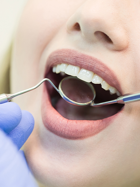 Konya cerrahi diş çekimi operasyonu DentReal Meram